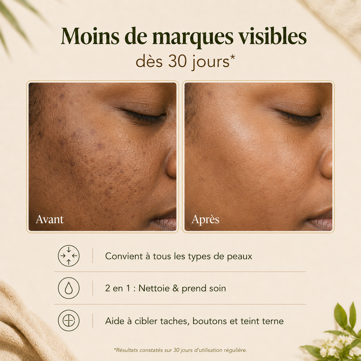 Cotons Traitement Imperfections